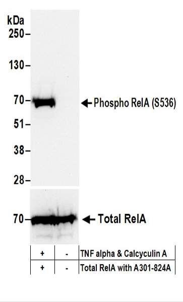 Anti-phospho-RelA (Ser536)