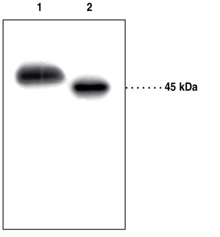 Anti-PAF Acetylhydrolase
