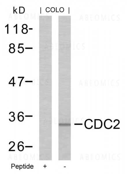 Anti-CDC2 (Ab-161)
