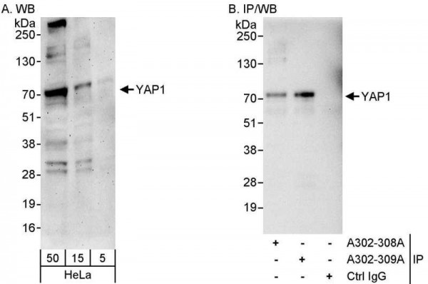 Anti-YAP1