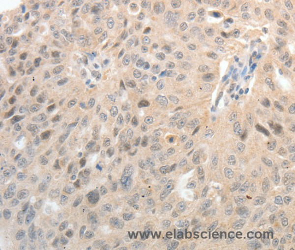 Anti-ASCL1