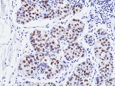 Anti-GATA3, Rabbit Monoclonal (RM482)