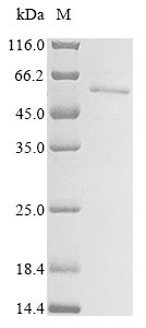 Melanoma-associated antigen 1 (MAGEA1), human, recombinant