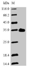 Asialoglycoprotein receptor 2 (Asgr2), partial, mouse, recombinant