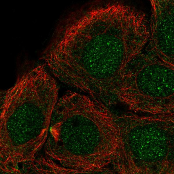 Anti-DNHD1