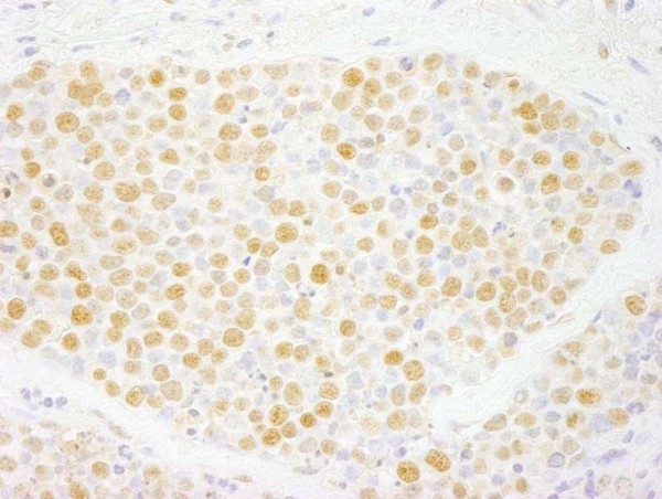 Anti-ZNF198 (IHC)