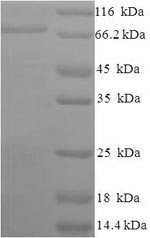 Apoptosis-inducing factor 1, mitochondrial (AIFM1),partial, human, recombinant
