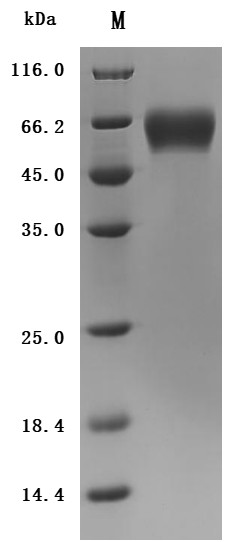 Interleukin 1 receptor accessory protein(IL1RAP), partial (Active), Macaca fascicularis, recombinant