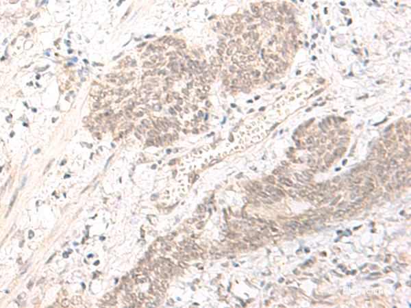 Anti-PBXIP1