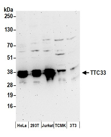 Anti-TTC33