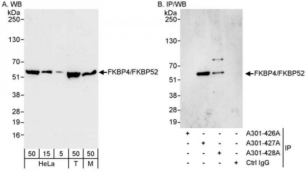 Anti-FKBP4/FKBP52