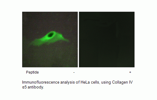 Anti-Collagen IV alpha5