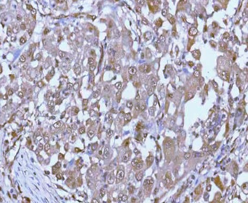 Anti-PSMC4