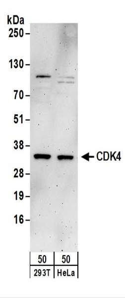 Anti-CDK4