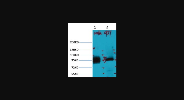 Anti-ABCB5, monoclonal