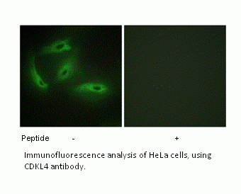 Anti-CDKL4