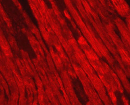 Anti-Cardiac Troponin I