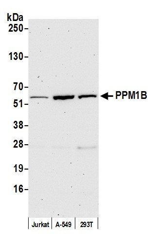 Anti-PPM1B