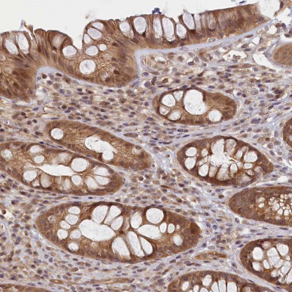 Anti-C19orf44