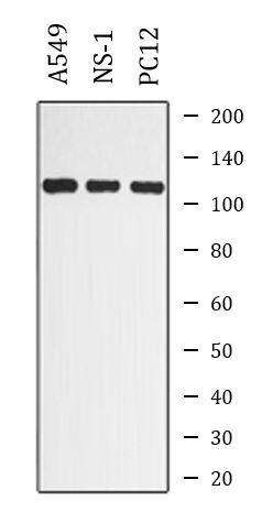 Anti-phospho-EphA7 (Tyr608)