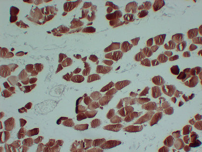 Anti-Sarcomeric muscle actin