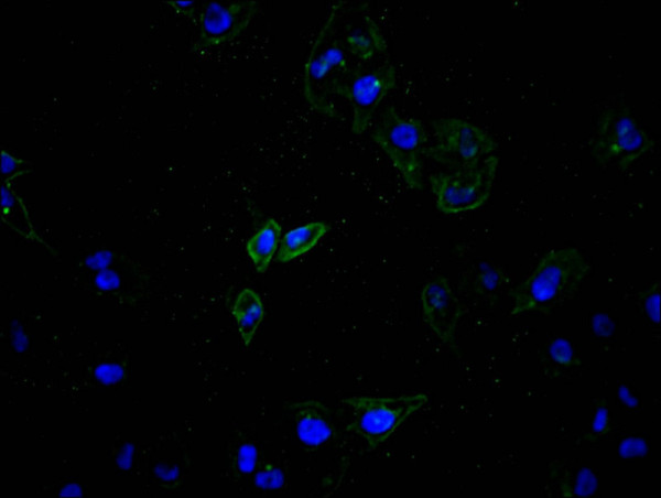 Anti-ATP7B Recombinant Monoclonal, clone 24A4