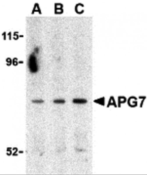Anti-ATG7