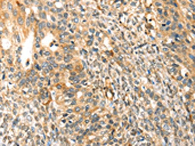 Anti-TRPV3