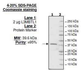 L3MBTL1, His-tag, human recombinant protein