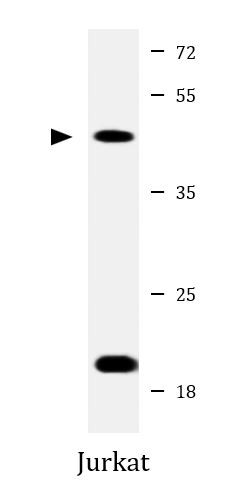 Anti-IL11RA