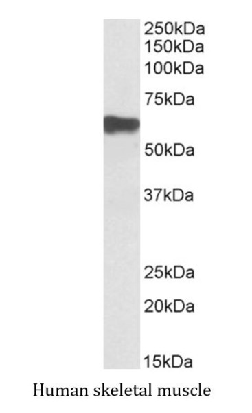Anti-Myotilin