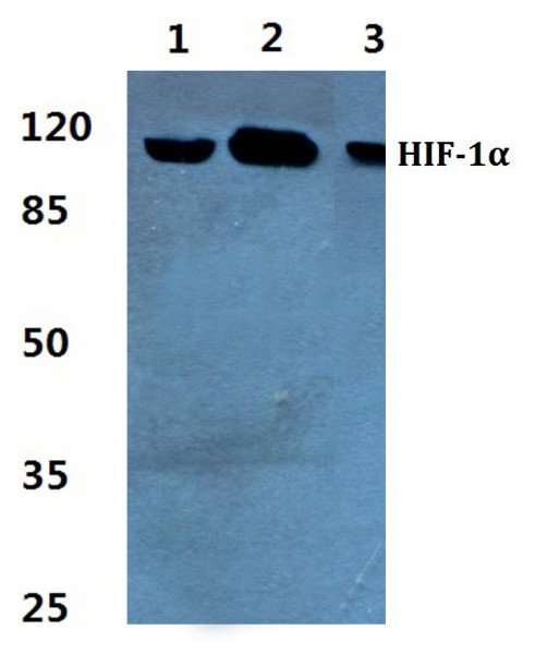 Anti-HIF-1 alpha