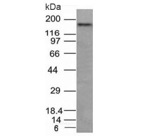 Anti-NCAM / CD56, clone NCAM1/795