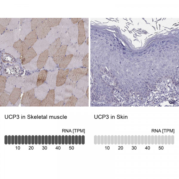 Anti-UCP3