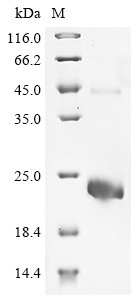 R-spondin-2 (RSPO2), partial, human, recombinant