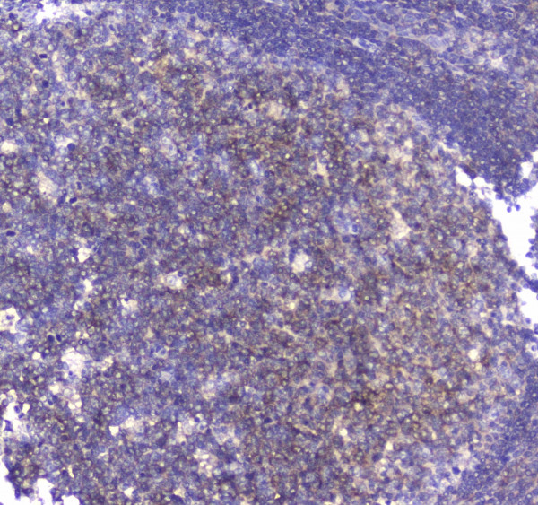 Anti-CD80