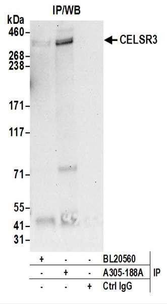 Anti-CELSR3/Flamingo Homolog 1
