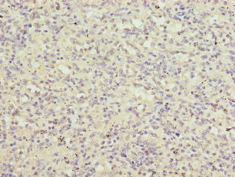 Anti-LRRC3B