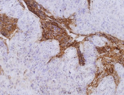 Anti-CD66e, clone CB30