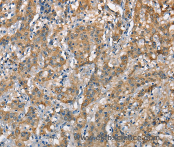 Anti-CSMD1