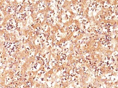Anti-AFP (Alpha Fetoprotein) (Hepatocellular/Germ Cell Tumor Marker)(Clone: C3)