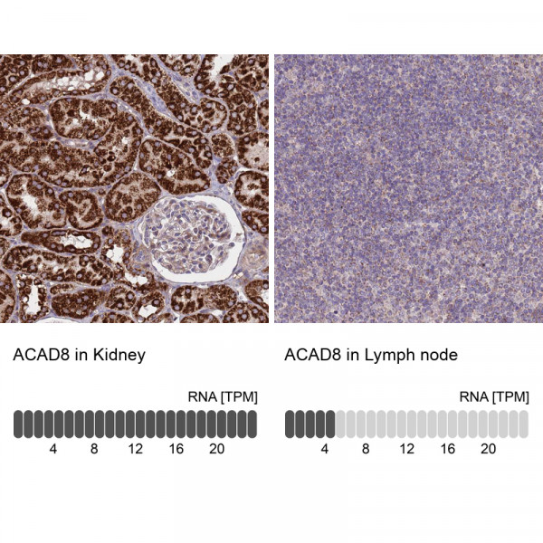 Anti-ACAD8