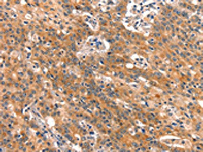 Anti-BCL3