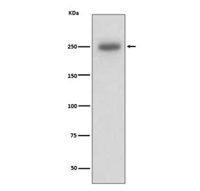 Anti-Laminin beta 1 / LAMB1, clone AODF-12