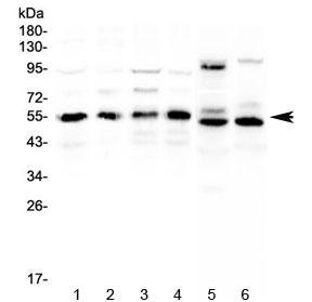 Anti-RXRA / Retinoic X Receptor alpha