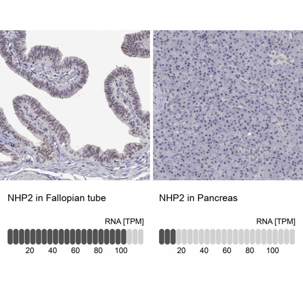 Anti-NHP2