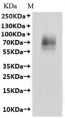 Solute carrier family 10 member 1 (SLC10A1)-VLPs, recombinant Macaca mulatta