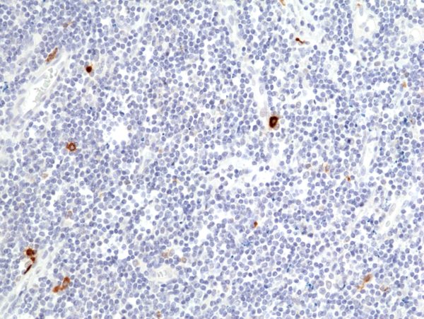 Anti-Granzyme B (human), Rabbit Monoclonal (RM441)