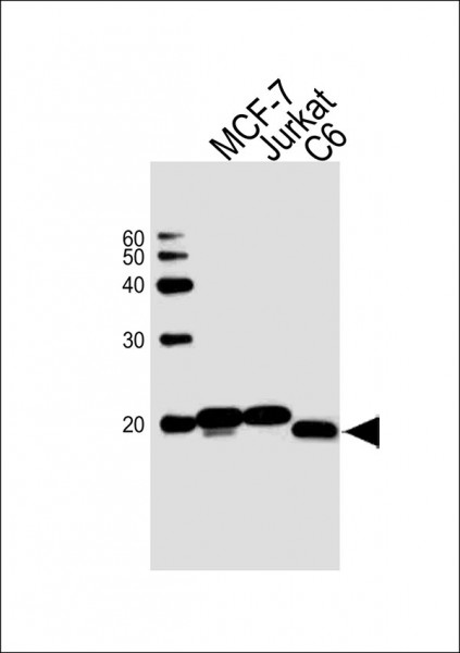Anti-NM23A, clone 1172CT2.4.1.1