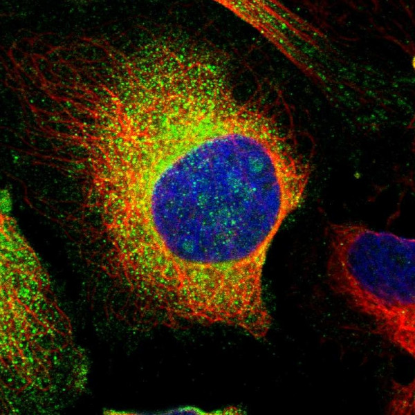 Anti-PCNX4